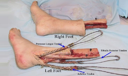 Cadaver Testing and Digital Human Modeling